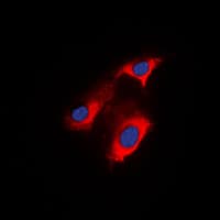 Polyclonal Rabbit anti-Human APC Antibody (C-Terminus, IHC, IF, WB)