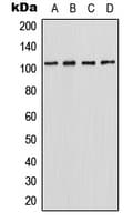 Polyclonal Rabbit anti-Human HIPK2 Antibody (C-Terminus, WB)