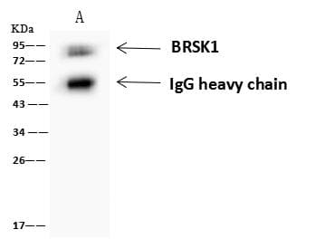 KIAA1811 / BRSK1 Antibody