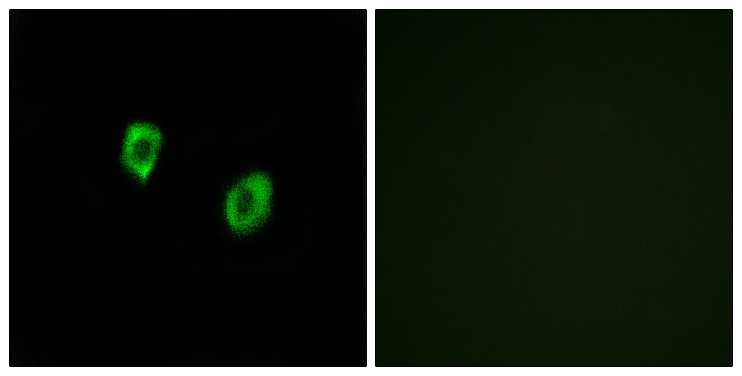 OR51F1 Antibody (aa269-318)