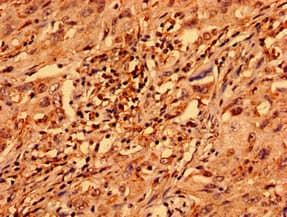 Polyclonal Rabbit anti-Human ZNF529 Antibody (WB)