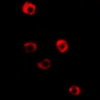 IHC-plus™ Polyclonal Rabbit anti-Human TPM3 Antibody (IHC, IF, WB)