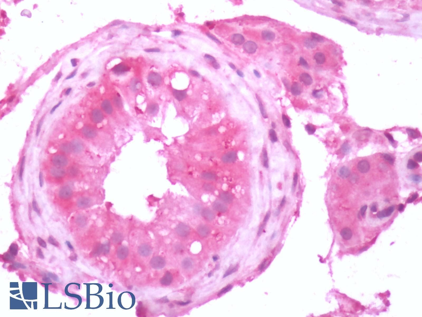 PathPlus™ GRM3 / MGLUR3 Antibody (N-Terminus)