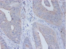 IL12B / IL12 p40 Antibody