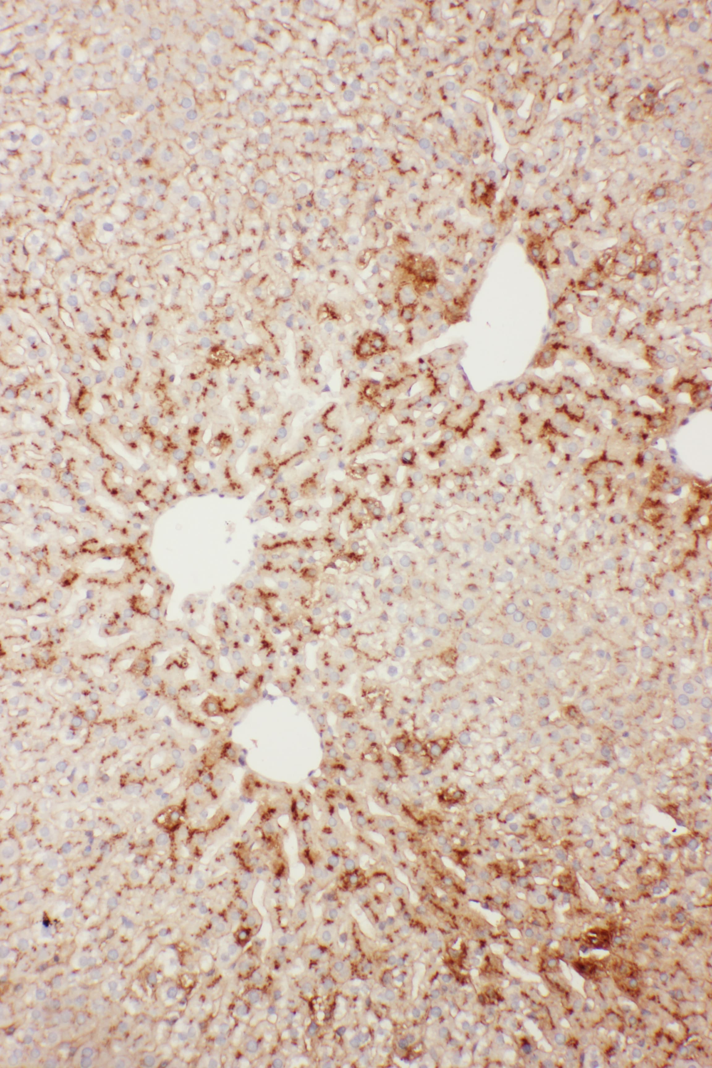 APCS / Serum Amyloid P / SAP Antibody (aa21-228)