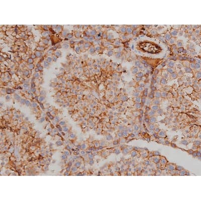 SYN / FYN Antibody (phospho-Tyr530)