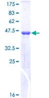 Human SOD2 / Mn SOD Protein (Recombinant GST)