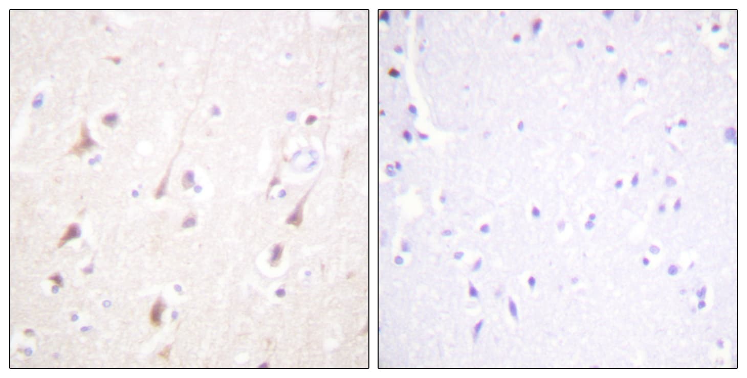IRS1 Antibody (aa760-809)