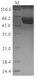 Mouse PKM / Pyruvate Kinase, Muscle Protein (Recombinant 10His, N-terminus + Myc, C-terminus)
