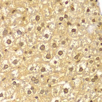PYCARD / ASC / TMS1 Antibody