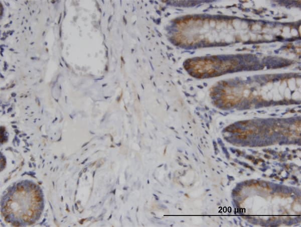 USP45 Antibody (clone 1H2)