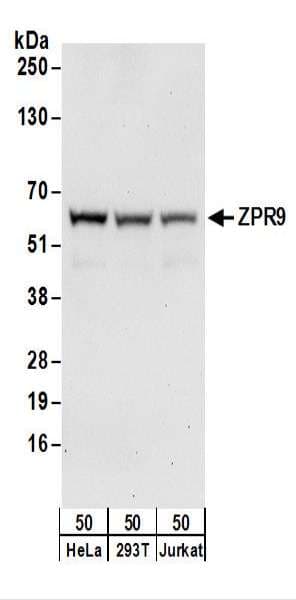 ZNF622 Antibody (aa150-200)