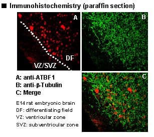IHC-plus™ Polyclonal Rabbit anti-Human ZFHX3 / ATBF1 Antibody (IHC, IF, WB)