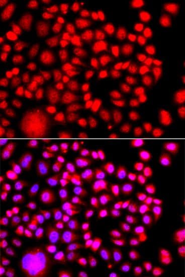 TESK2 Antibody