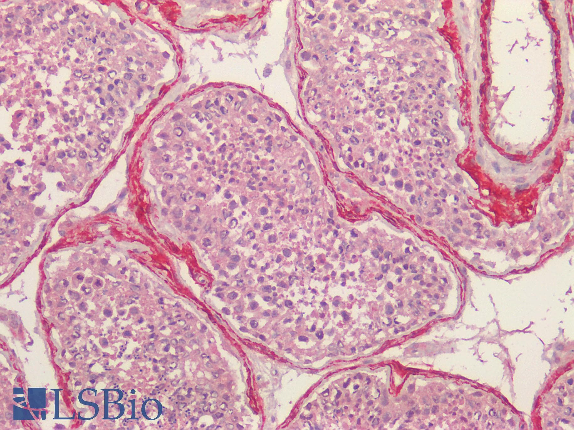 IHC-plus™ ACTA2 / Smooth Muscle Actin Antibody (N-Terminus)
