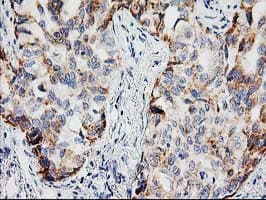 PPM1B Antibody (clone OTI3E8, Carrier-free)
