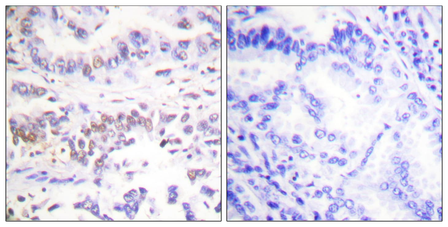 XRCC3 Antibody (aa41-90)