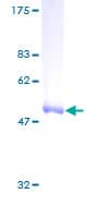 Human RAB6B Protein (Recombinant GST)