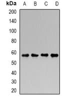GALNS / Chondroitinase Antibody