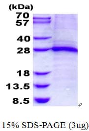 Human TNNI1 Protein (Recombinant His)