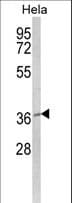 MOSC2 Antibody (aa270-300)