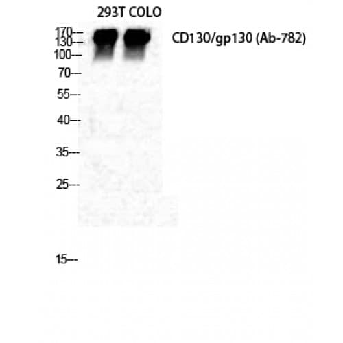 IL6ST / CD130 / gp130 Antibody (720-800 aa)