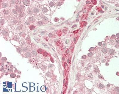 IHC-plus™ TEFM Antibody