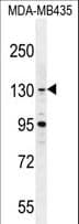 GLTSCR1 Antibody (aa1112-1139)