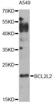 PathPlus™ Polyclonal Rabbit anti-Human BCL2L2 / Bcl-w Antibody (IHC, WB)