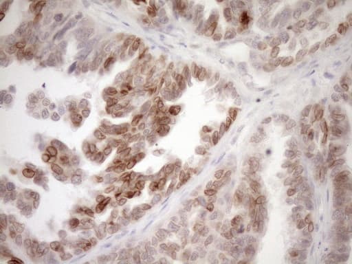 MED15 / ARC105 Antibody (aa393-679, clone OTI1C11)