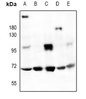 PMEL / SILV / gp100 Antibody