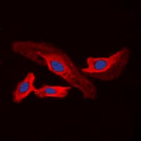 CHPF / CHSY2 Antibody (C-Terminus)