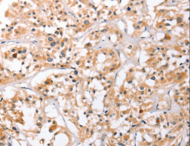 HDAC8 Antibody
