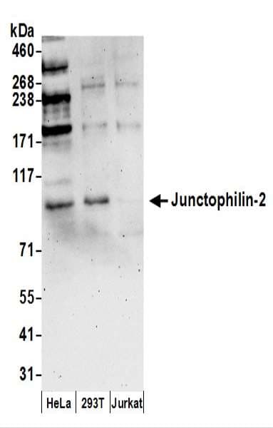 Junctophilin 2 / JPH2 Antibody (aa625-675)