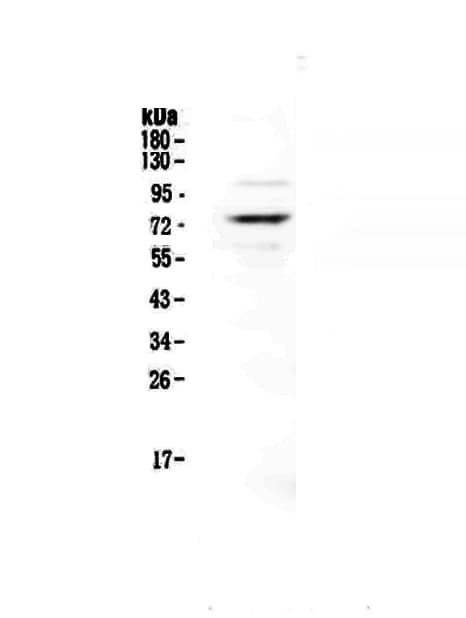Polyclonal Rabbit anti-Human PROS1 / Protein S Antibody (WB)