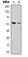 DMTN / Dematin Antibody (C-Terminus)