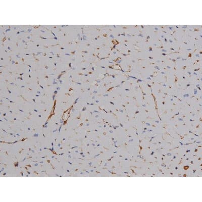 Polyclonal Rabbit anti-Human ZAP70 Antibody (phospho-Tyr319, IHC, IF, WB)