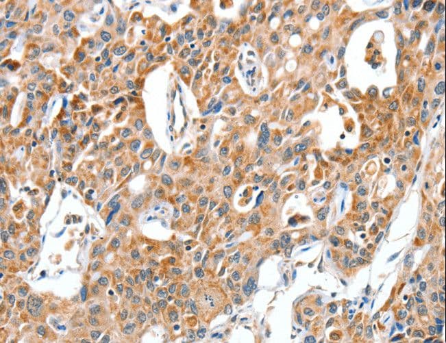 BAX Antibody