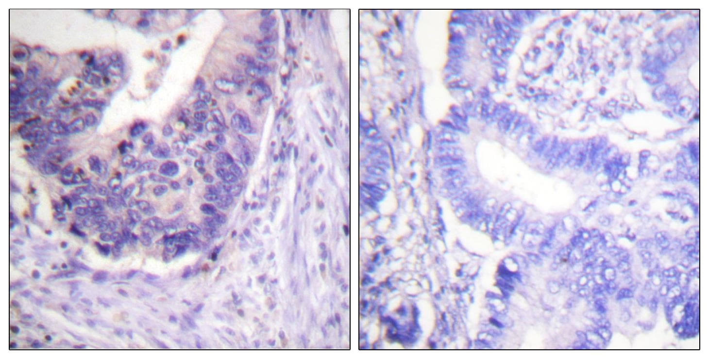 Polyclonal Rabbit anti-Human PDE4D Antibody (phospho-Ser190/53, IHC, WB)