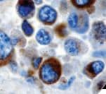 Melanosome Antibody (clone HMB-45, Ready-to-Use)