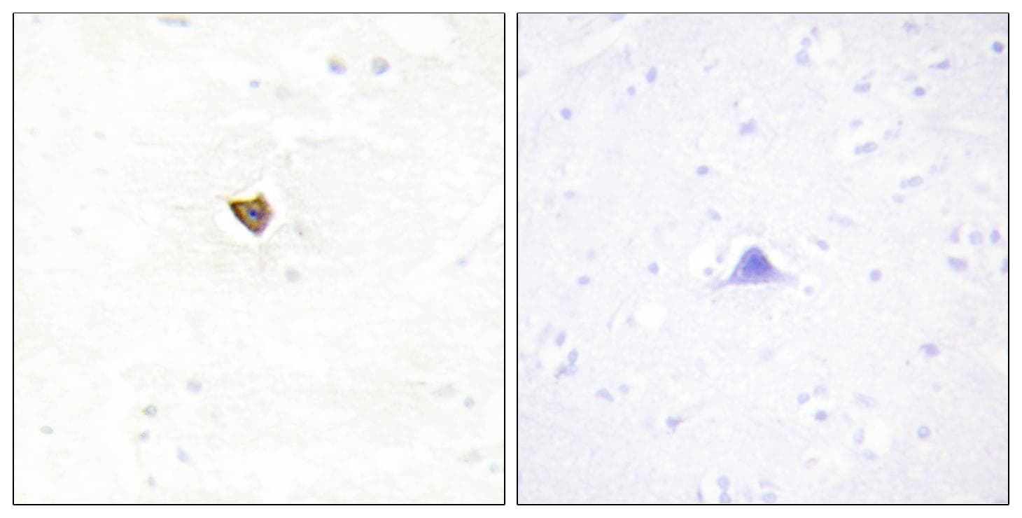JAKMIP2 Antibody