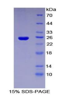 Human SPRY3 / Sprouty 3 Protein (Recombinant His-T7)