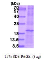 Human CLEC5A / MDL-1 Protein (Recombinant His)