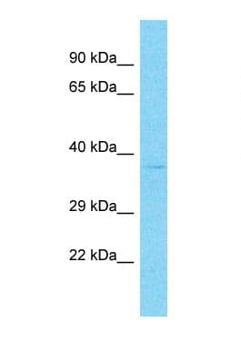 OR9Q2 Antibody (C-Terminus)