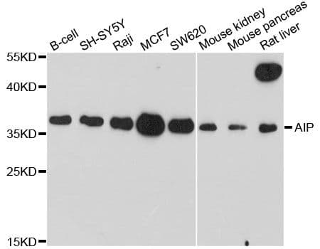 ARA9 / AIP Antibody