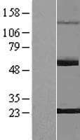 PNLDC1 Protein (Over-Expression Lysate Myc-DDK (Flag))