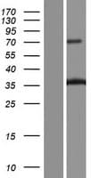 COL11A2 / Collagen XI Protein (Over-Expression Lysate Myc-DDK (Flag))
