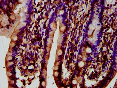 Polyclonal Rabbit anti-Human SYNJ1 / Synaptojanin Antibody (IHC, IF)