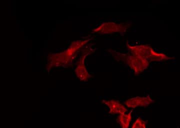 Polyclonal Rabbit anti-Human TAOK3 / JIK Antibody (IF, WB)