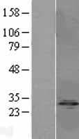 IPP2 / PPP1R2 Protein (Over-Expression Lysate Myc-DDK (Flag))